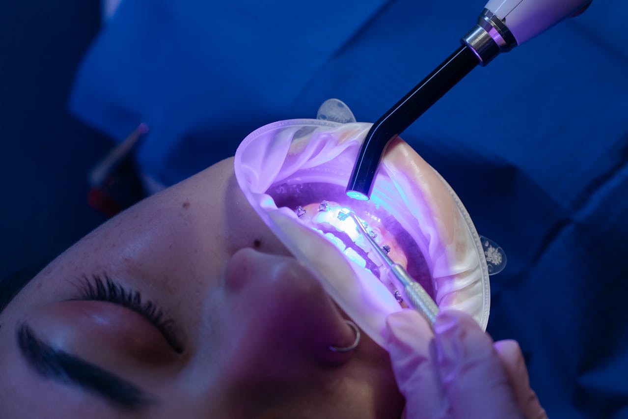 Discover Effective Sealants for Teeth at Trailhead Pediatric